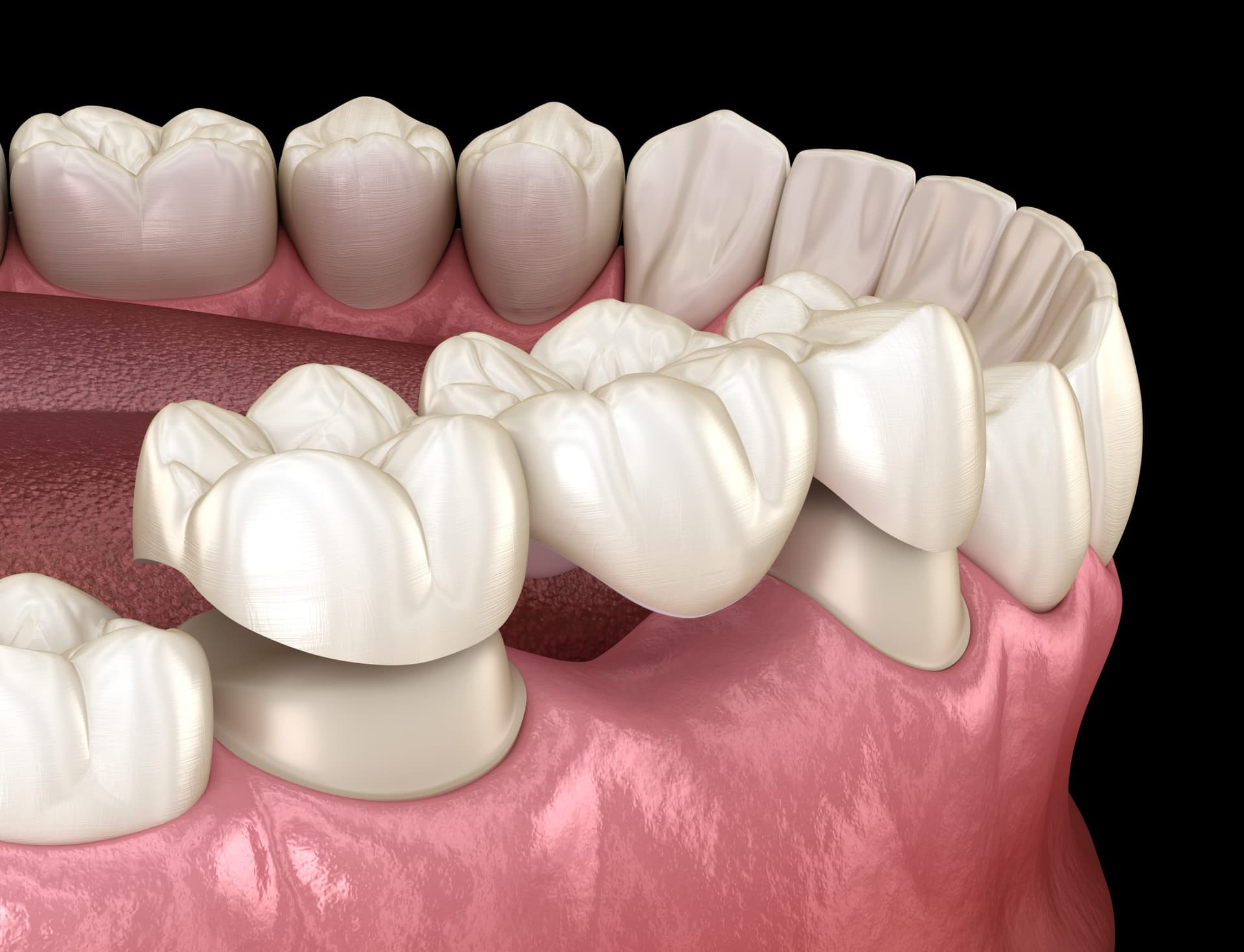 Oral Health