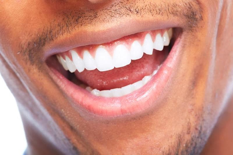 Dental Implants Smile