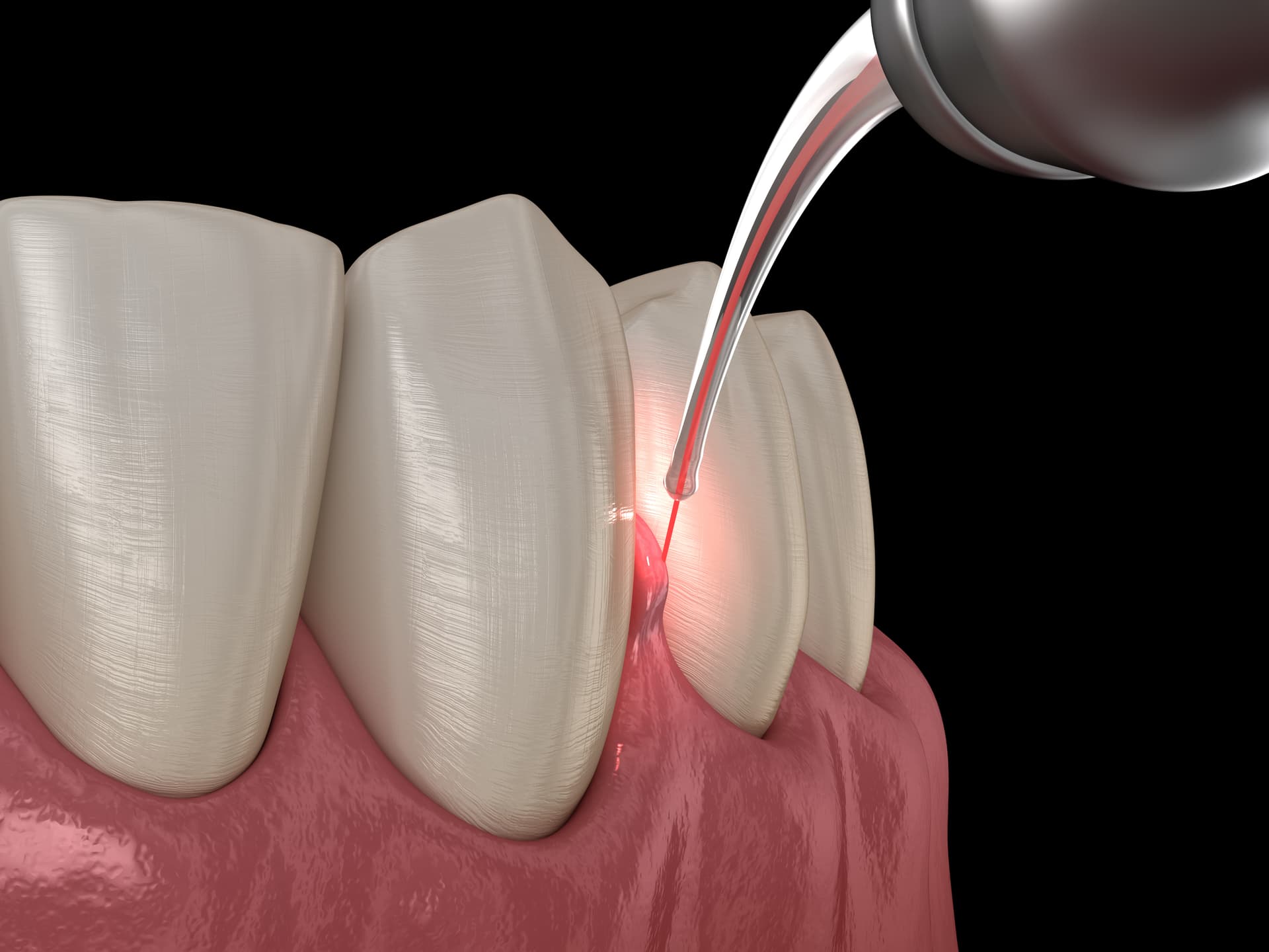 Oral Health