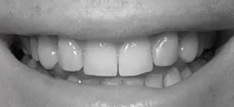 Dental treatment before procedure in Phoenix, AZ