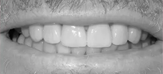 Dental treatment after procedure in Phoenix, AZ